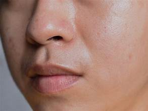 Oily Skin - Botika Skincare